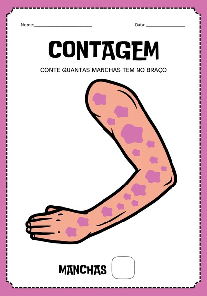 Contagem - Curando os Dez Leprosos